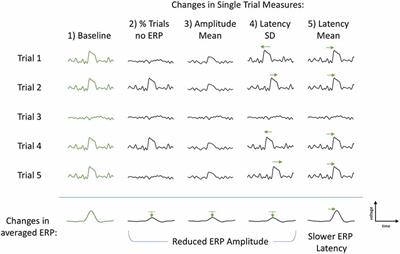 Single-Trial Mechanisms Underlying Changes in Averaged P300 ERP Amplitude and Latency in Military Service Members After Combat Deployment